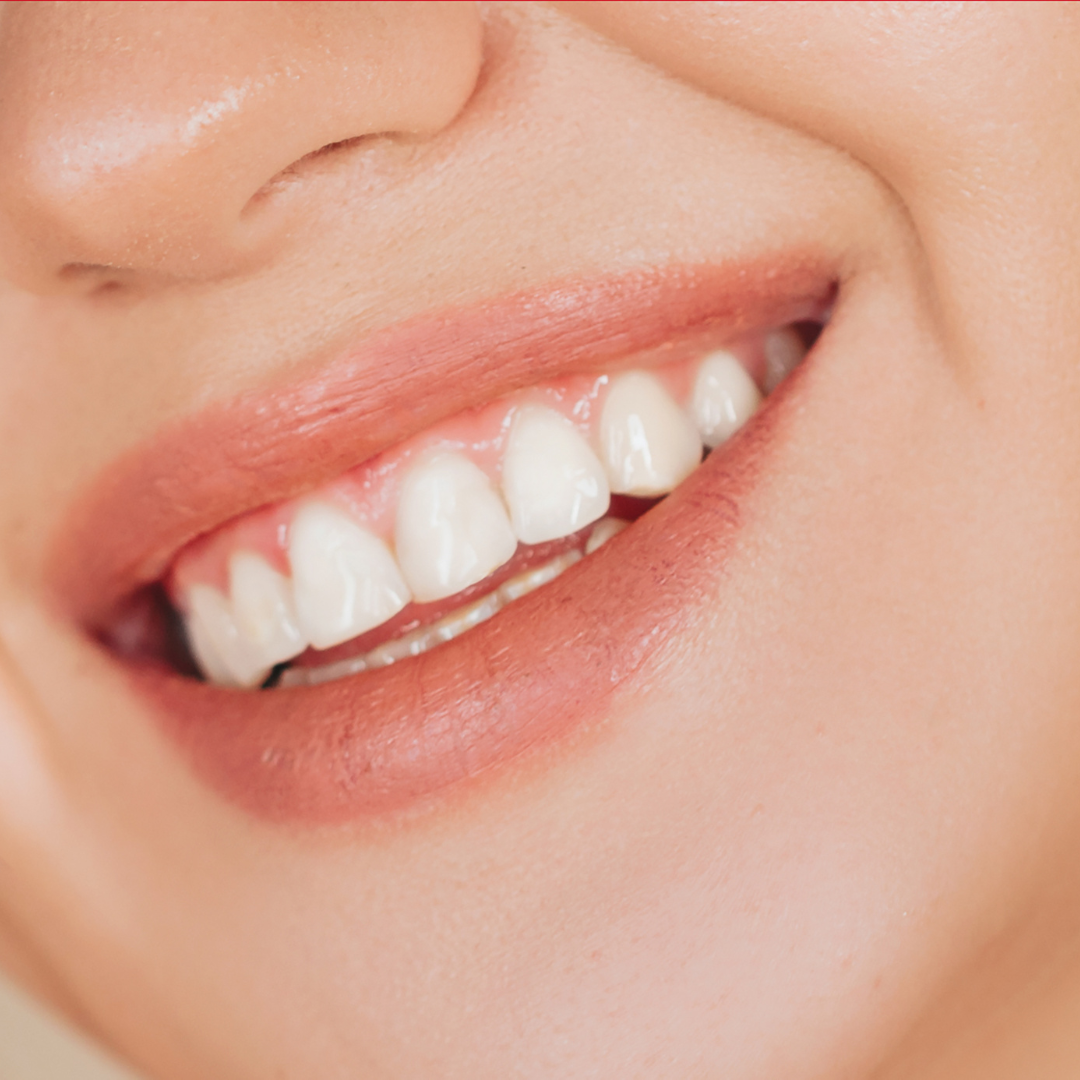 How to keep my dental implants white?